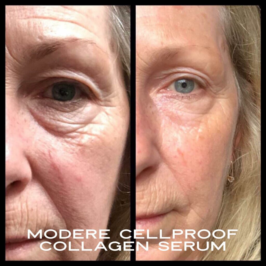 CellProof collagen serum Before and After photos of left face