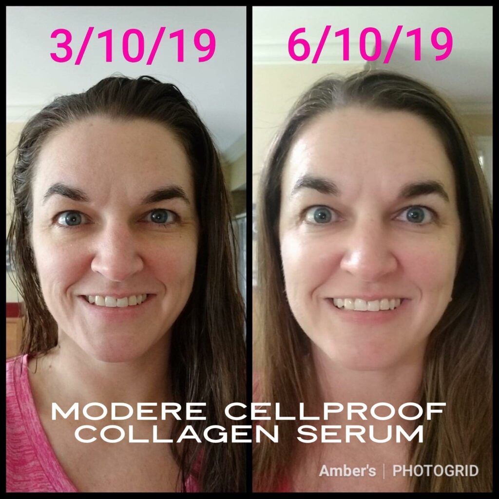 CellProof collagen serum Before and After photos of full face
