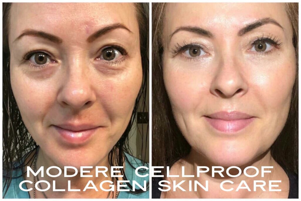 90 Day Modere CellProof Skin Care Results