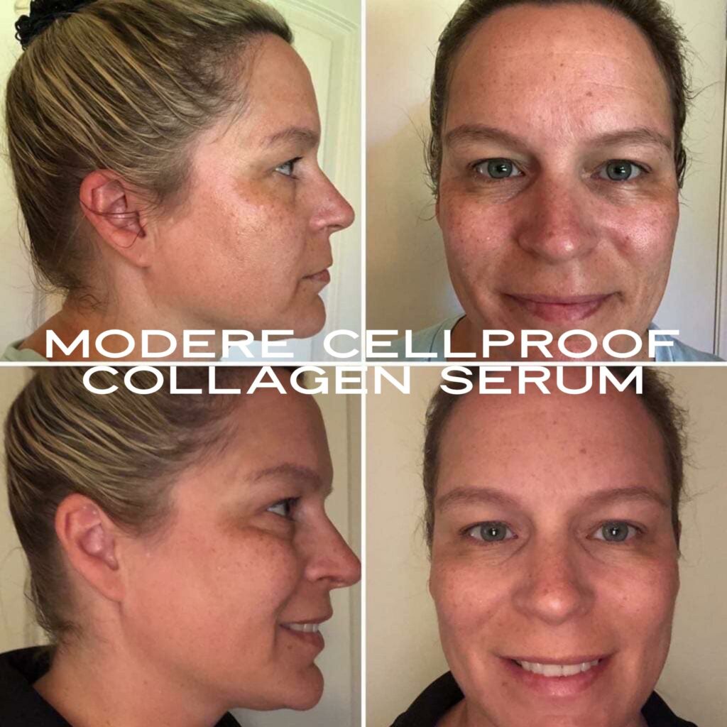 Modere CellProof Collagen Skin Care Results