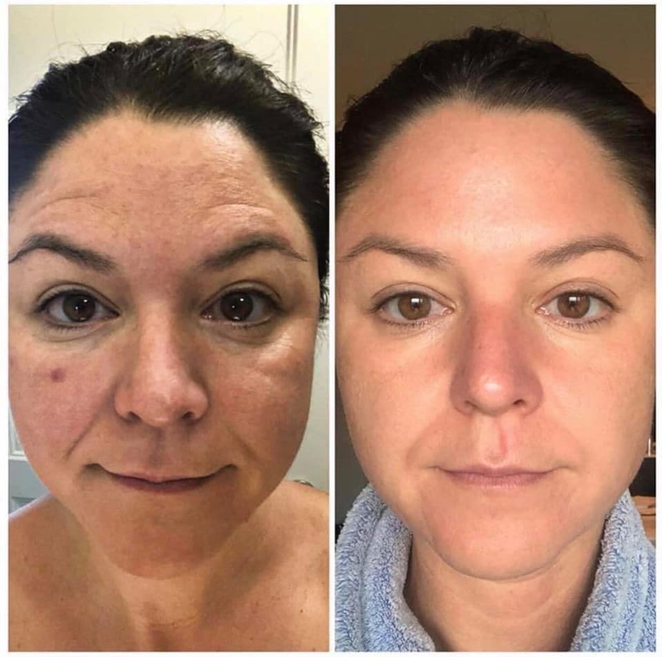 Modere CellProof Collagen Serum 90 day results