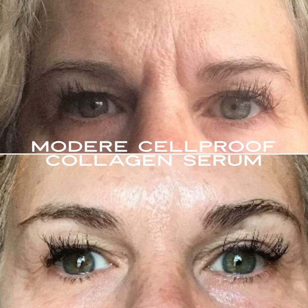 CellProof collagen serum Before and After Photos of eyes