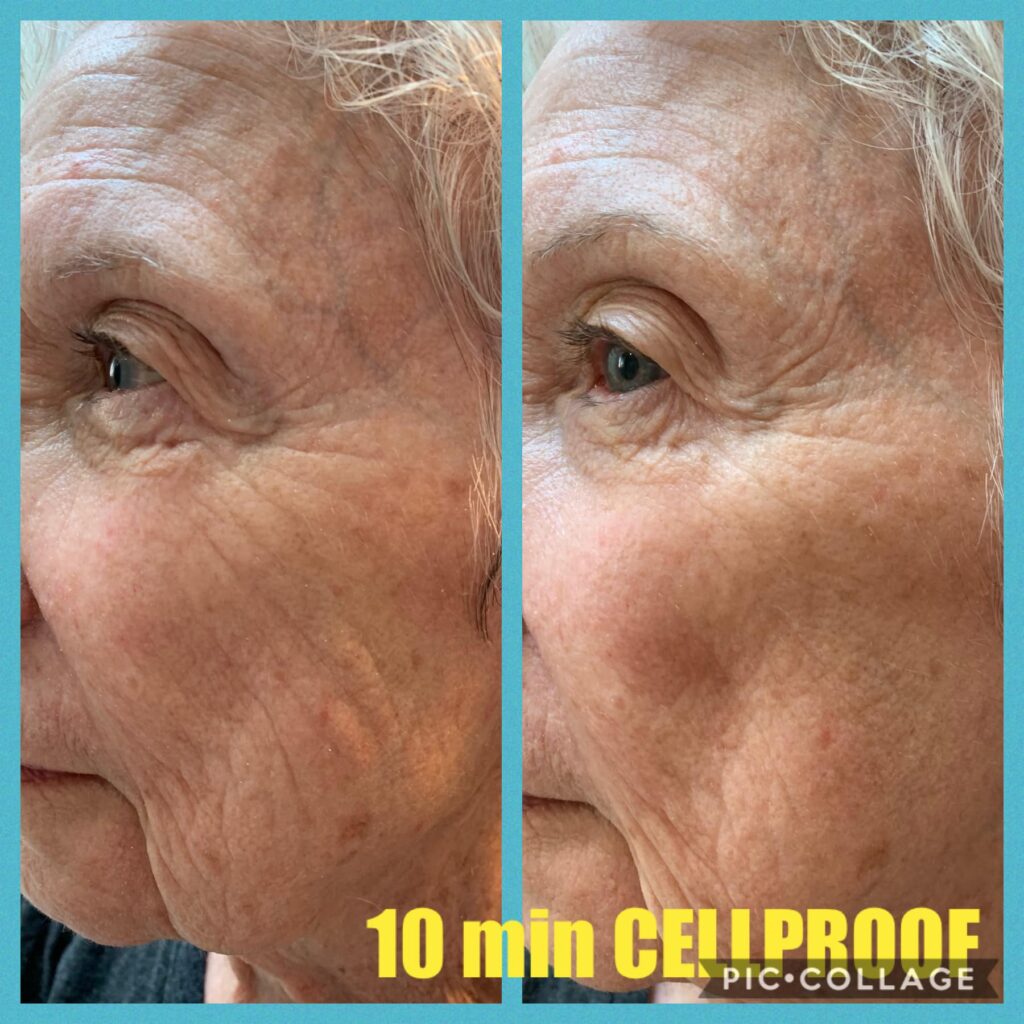 Modere CellProof Collagen Serum's 10 Minute Results
