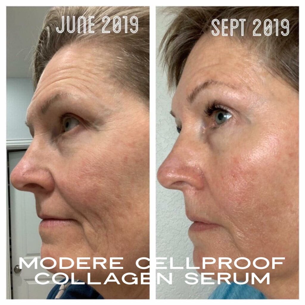 3+ Month Results with Liquid BioCell and CellProof Serum